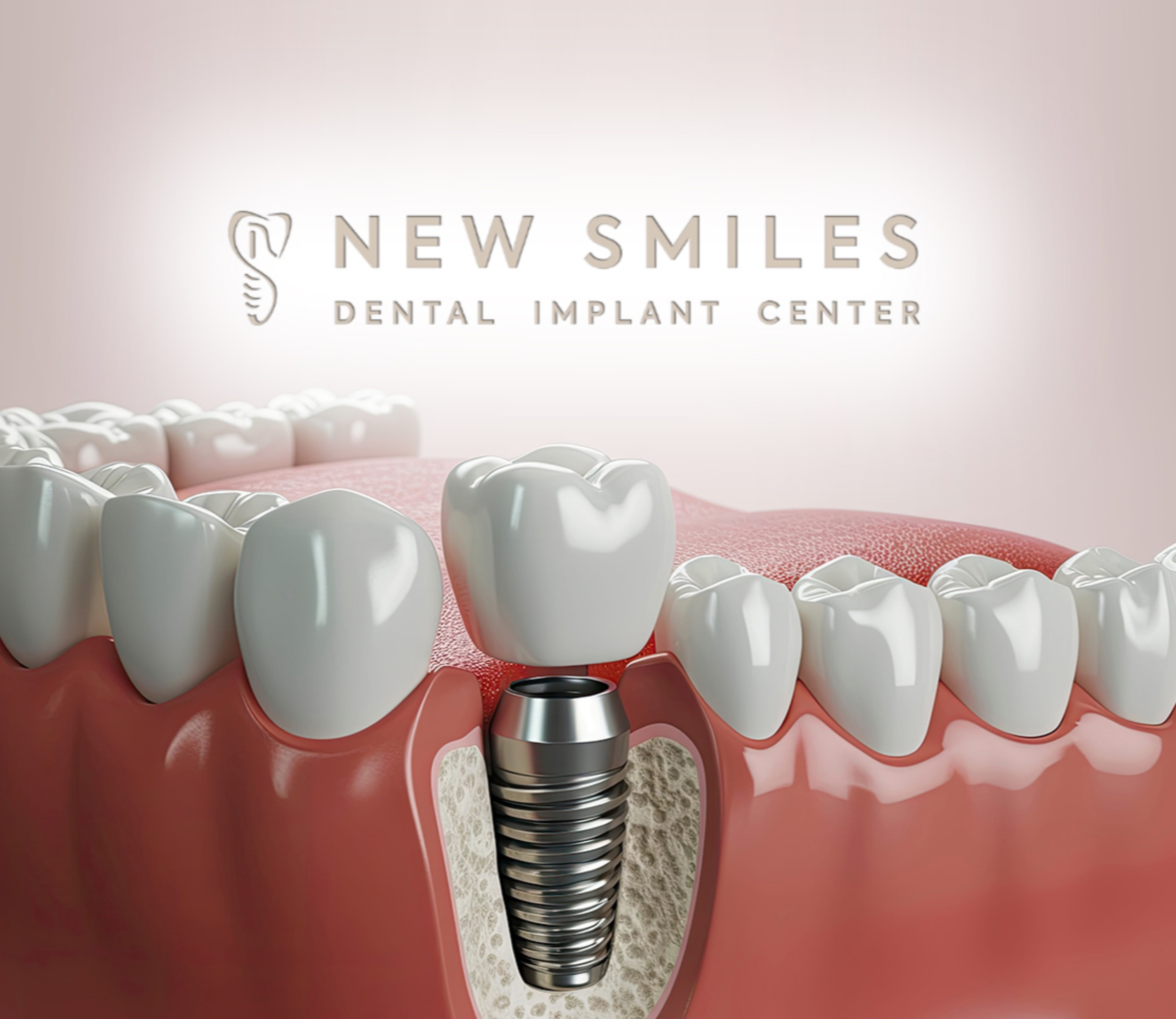 New Smiles Dental Implant Center